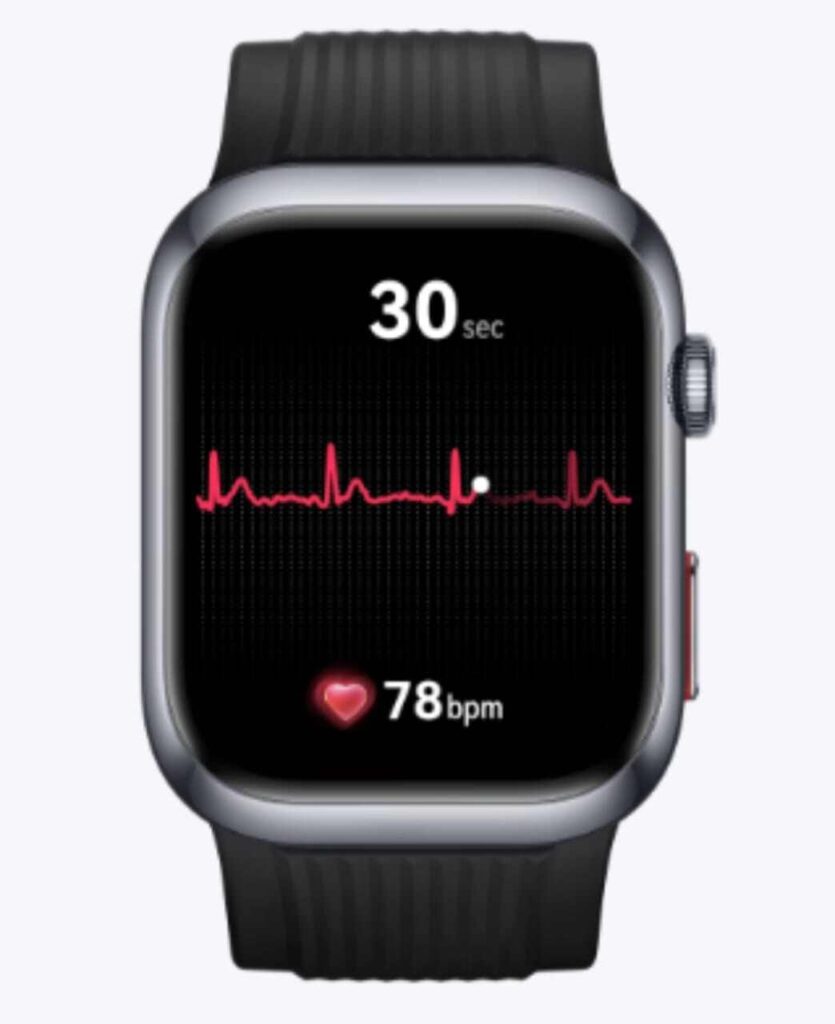 ECG Analysis